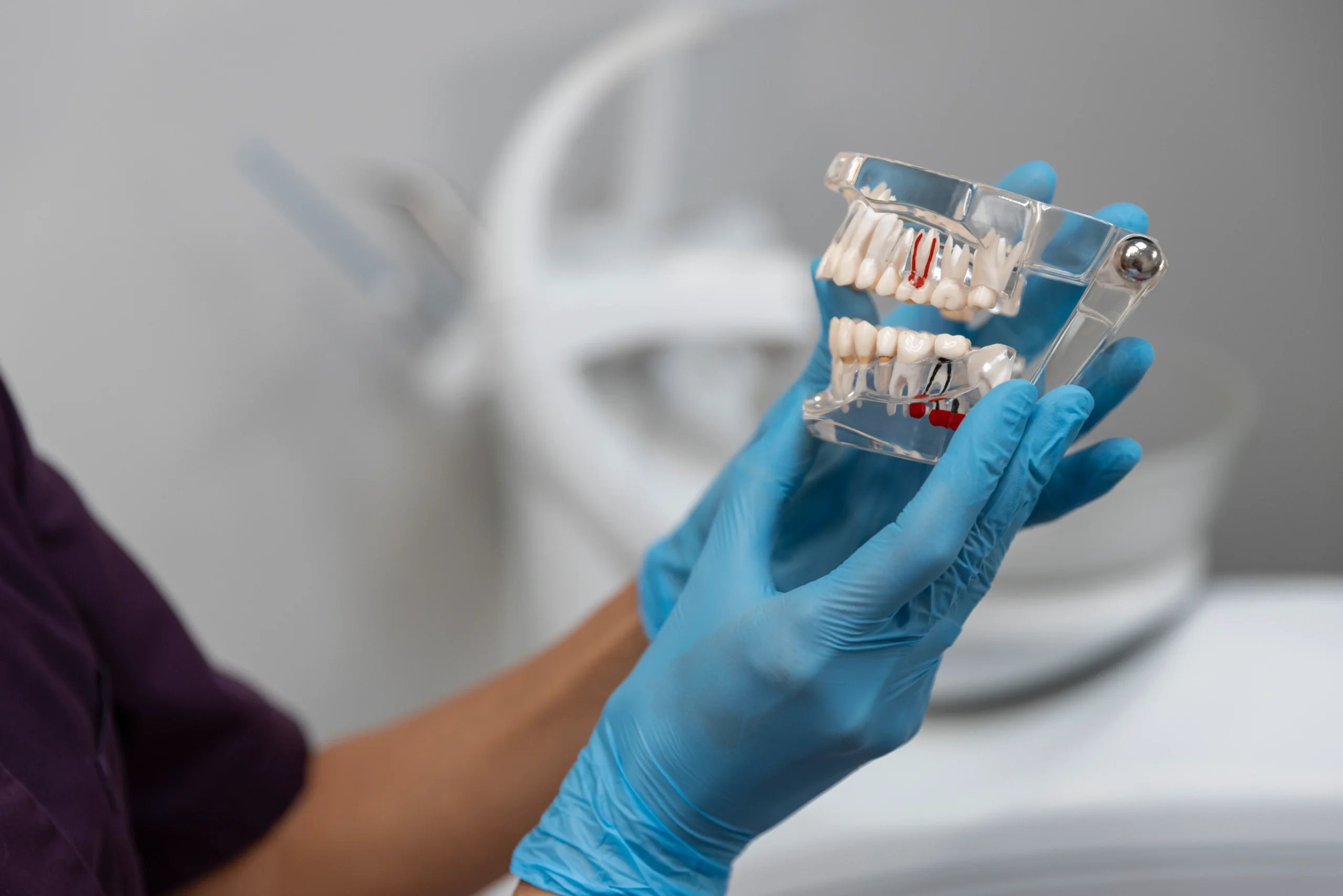 Dental implant treatment in clinic