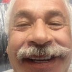 All-Decayed-Teeth-Missing-Teeth4